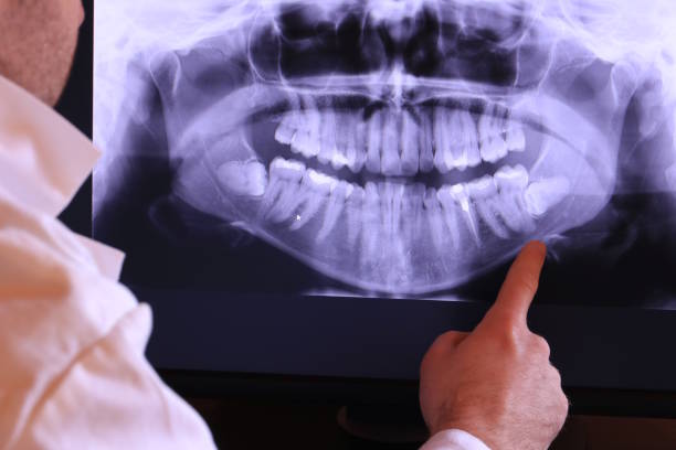 Best Emergency Dental Care for Broken or Chipped Teeth in Auburn Lake Trails, CA