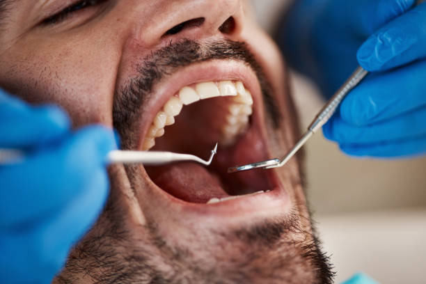 Best Emergency Treatment for Dental Infections or Abscesses in Auburn Lake Trails, CA