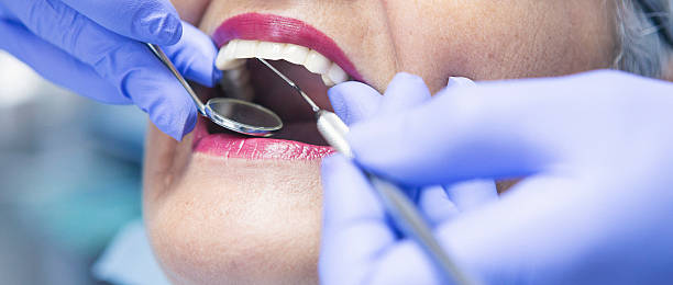 Best Urgent Care for Lost Fillings or Crowns in Auburn Lake Trails, CA